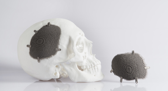 3D-Printed Medical Part