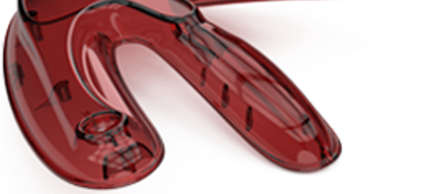 Designing for Mouuldability: Volume 2