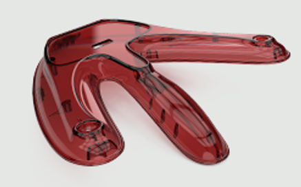 Enhancing Cosmetic Appearance on Molded Parts