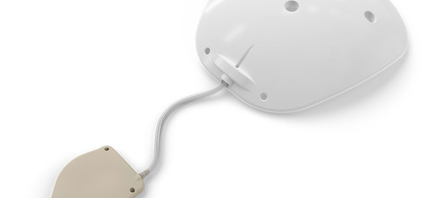 The first adjustable implant for glaucoma treatment by Rheon Medical