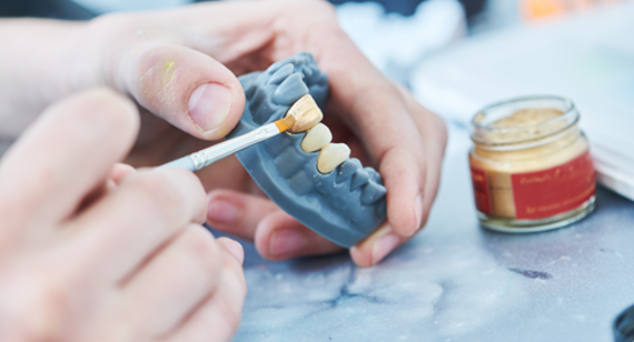 dental mould painting from 3d print