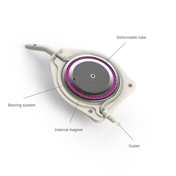 Innovating production for Rheon Medical Products
